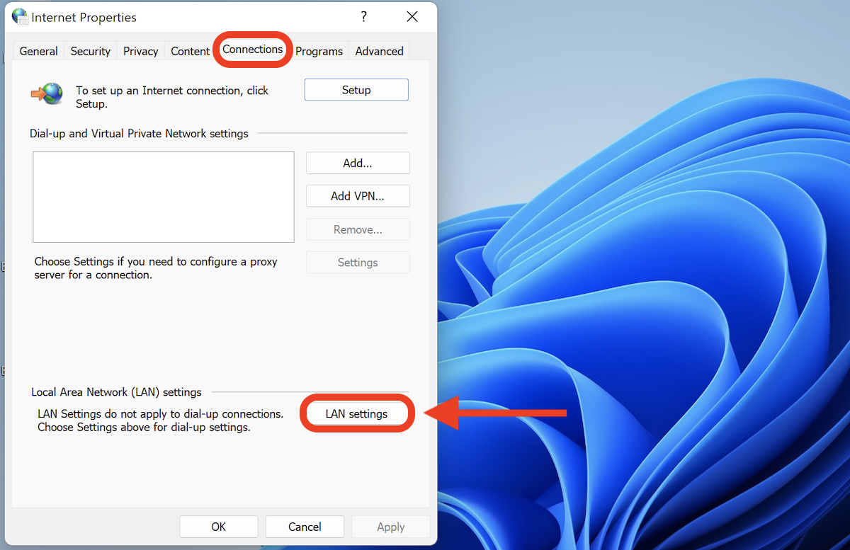 LAN settings